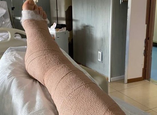 AUGURI GIANLUCA DELIGIA!/ Operato oggi lo sfortunato giocatore del Samugheo che aveva riportato la frattura della tibia e del perone